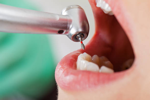 Best Emergency Denture Repair in Frederick, OK